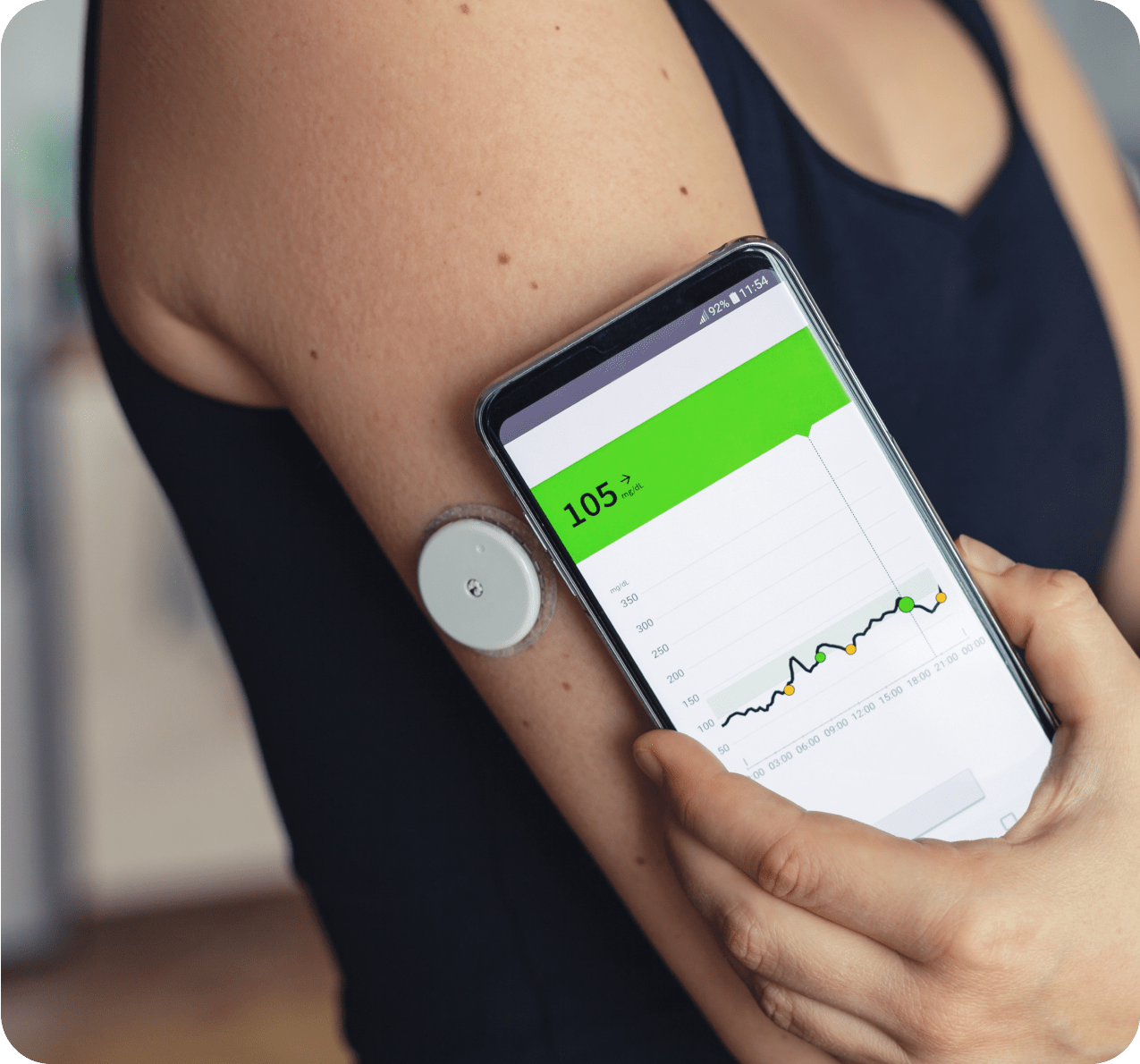 Continuous Glucose Monitor Person with a continuous glucose monitor looking at a phone screen and connected device that show readings