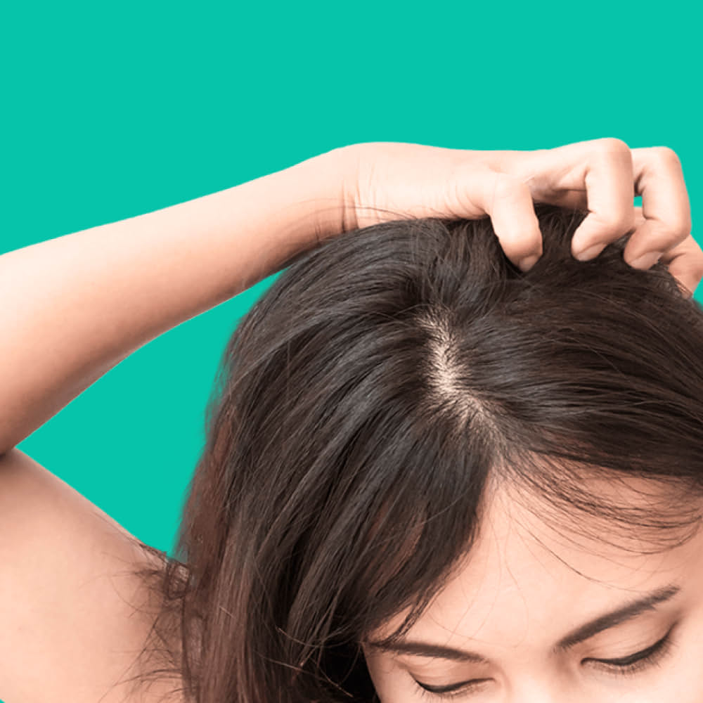 Girl with lice symptoms scratches head to get rid of lice and eggs