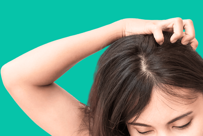 Girl with head lice symptoms scratches head