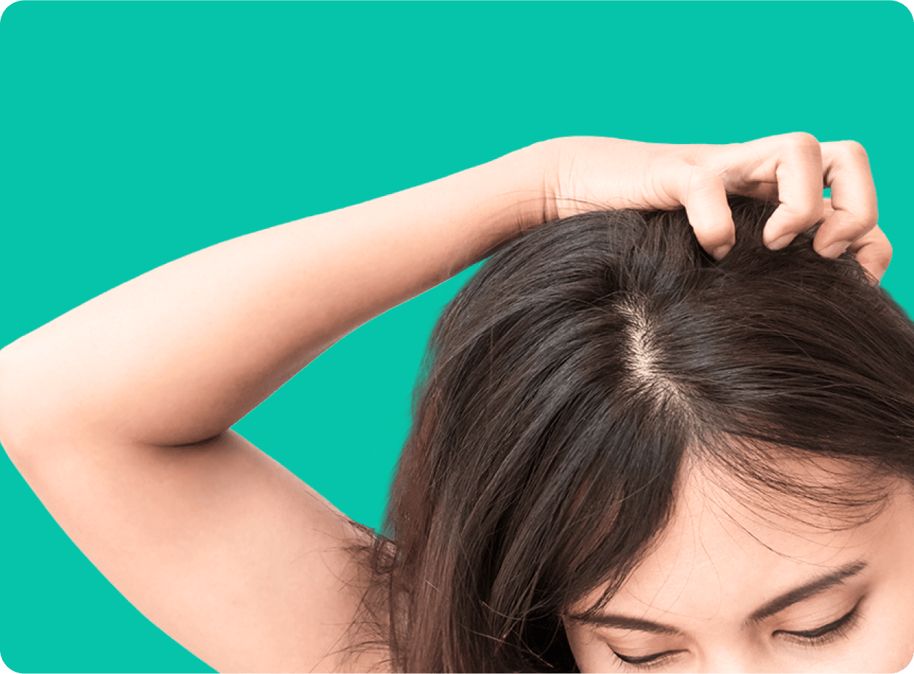 Online head lice treatment from Amazon One Medical Girl with lice symptoms scratches head to get rid of lice and eggs