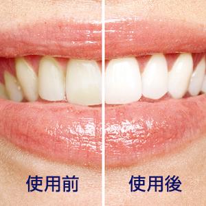 Amazon.co.jp: フィリップス ソニッケアー ヘルシーホワイト