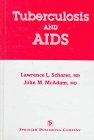 Tuberculosis And AIDS: The Relationship Between Mycobacterium Tb And ...