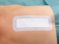 25Pcs Adhesive Wound Dressings 10cm X 10cm, Breathable Sterile Dressings, Hypoallergenic Plasters For Wounds Cuts And Grazes, Diabetic Leg Ulcers, Venous Leg Ulcers, Small Pressure Sores - View #11