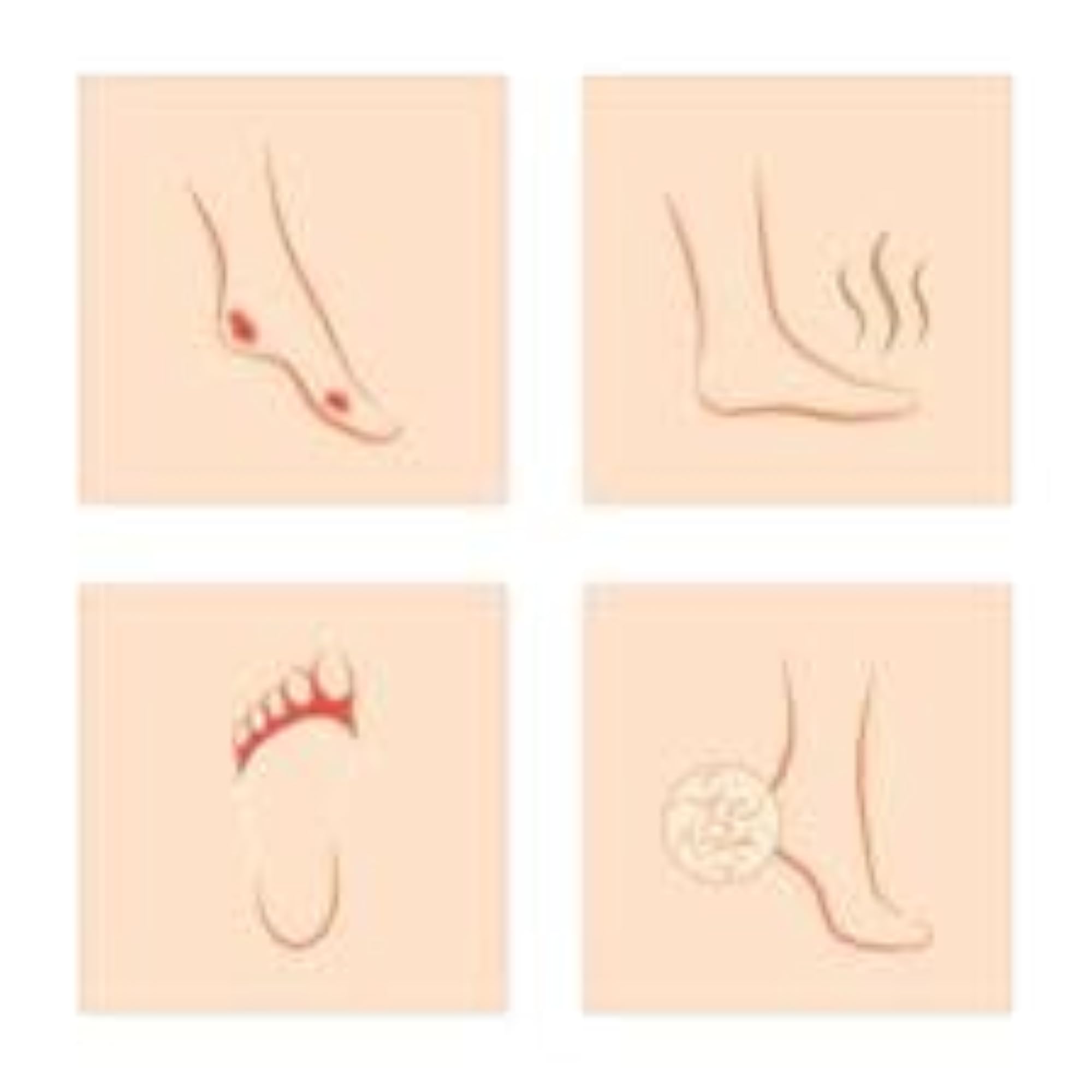 Foobetik Cream, Foot Care for Diabetic, Moisturizes & Soothes Feet