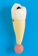 See full amazon price history chart for iDENTical Endodontic Treatment Model (M4007-2) iDENTical Endodontic Treatment Model (M4007-2) (B0BWNJWL4V) Amazon Price History, Amazon Price Tracker