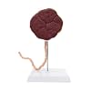 Axis Scientific Placenta Model with Removable Umbilical Cord Anatomical Model - Birthing Anatomy Model, Placenta Umbilical Cord Anatomical Model, Education for Medical School