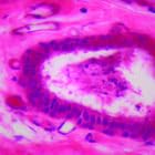 Miniatura 3 de Epitelio columnar estratificado humano, diapositiva del microscopio de 7 M H&E