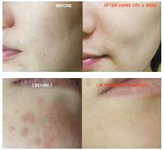 Siero alla vitamina C 20% per il viso ora