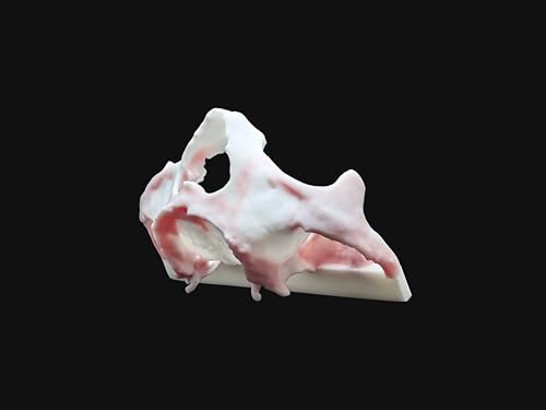 Modèle dentaire anatomique 3D maxillaire supérieure atrophique pour cas cliniques