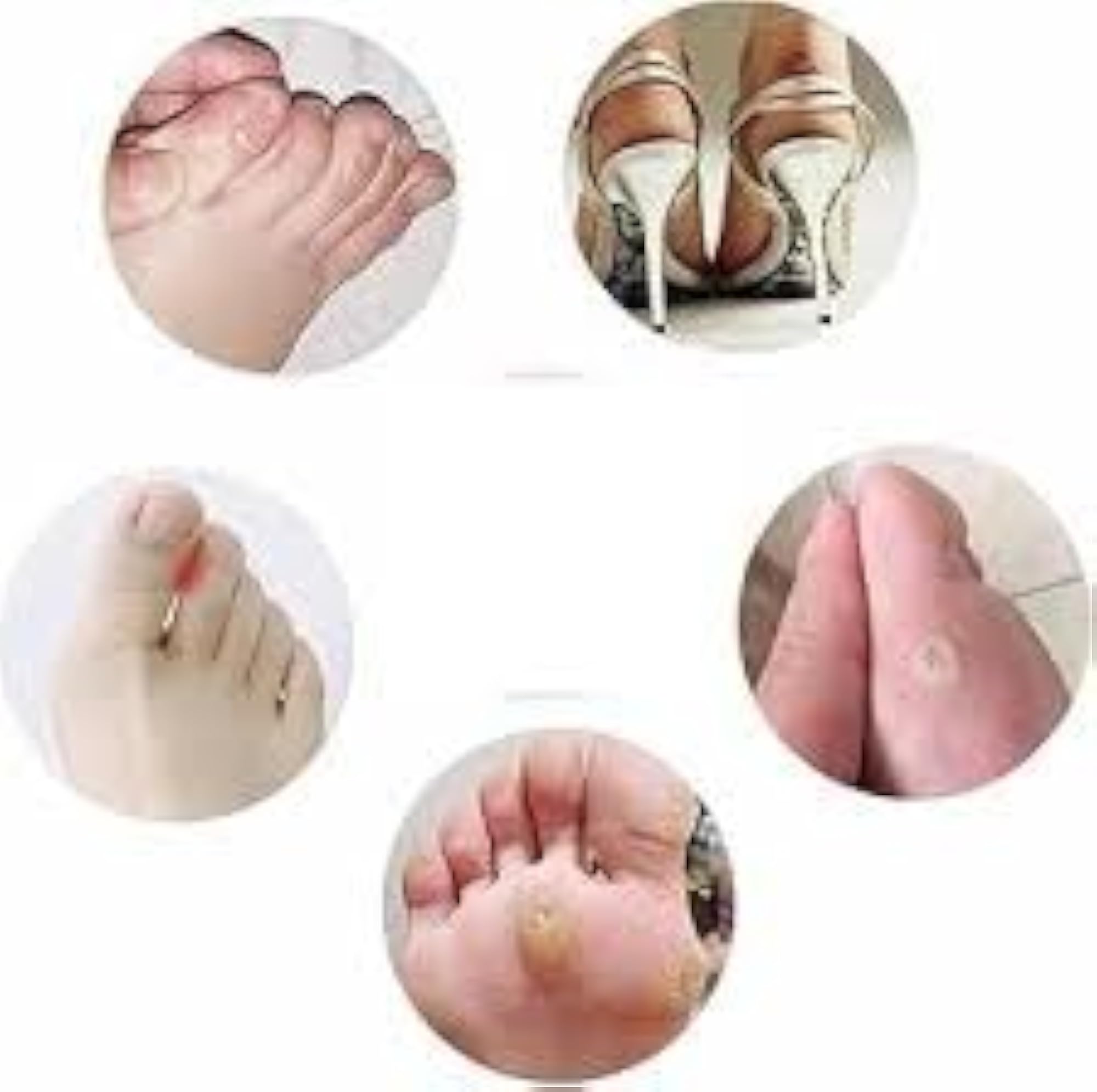 HEEL PAD C SHAPE, U-Shaped Gel Callus Pads