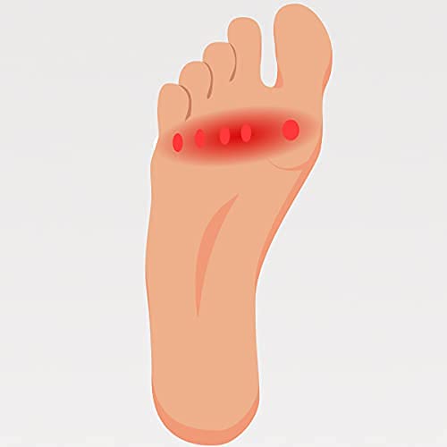 Metatarsalgia - Plantari Ortopedici Anatomici