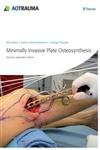 Minimally Invasive Plate Osteosynthesis (MIPO) 2nd