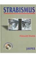 Strabismus: 9788180612466: Medicine & Health Science Books @ Amazon.com