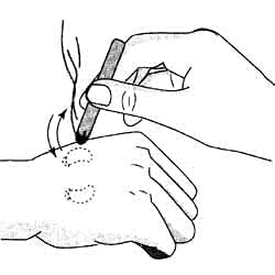 RDE home care Moxa Box Acupuncture Stick, Sujok, Moxa Rolls For Moxibustion (Set Of 10 Pieces) 3 217aUOc2O7L