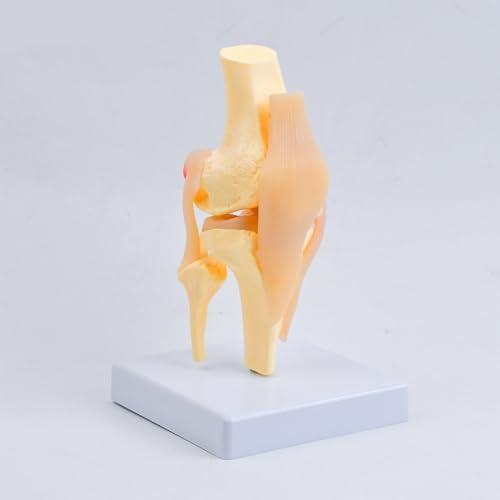 Modelo anatómico de rótula de rodilla: la solución visual para explicar lesiones ligamentosas 4