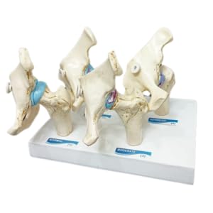 KKI Highly Detailed 4 Stage Human Hip Joint Athritis Model For Demonstration & Medical Training | Anatomical Model Made with Durable PVC Material (B0CZS6QSNG) Amazon Price History, Amazon Price Tracker