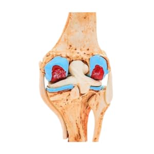 Kay Kay Industries Human Life Size Knee Joint Model and Human Mini Arthritic Knee Model Set | Hinghly Detailed and accurate Perfect for Medical Professionals and Training 3