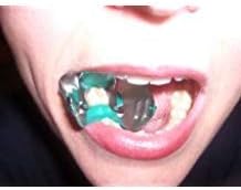 Dental Rubber Dam Clamp Set