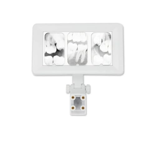 Xray Film Viewer Film Illuminator Light Mini Oral Hygiene Panorama Viewbox Tools