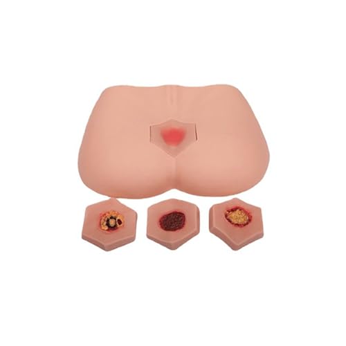 Modèle infirmier d'escarres 4 stades pour formation et stage de soins