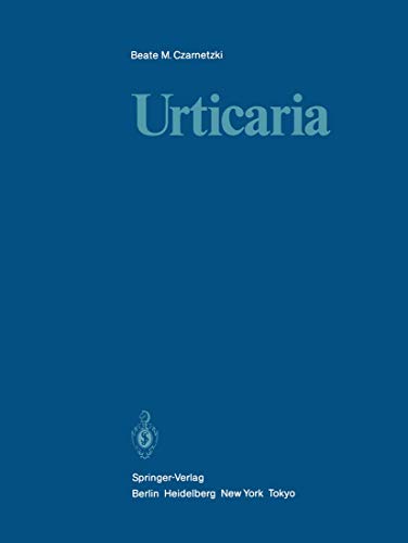 Urticaria view 2