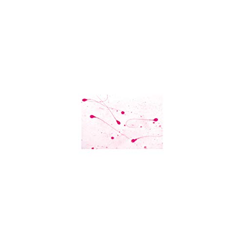 Image of 3B Scientific GmbH W13316 Genital System-German
