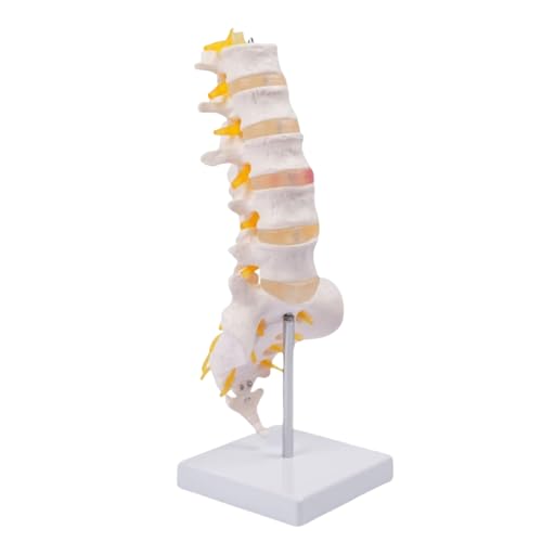 Image of Human Anatomical Lumbar Disc Herniation Model Life Size Lumbar Spine Model for Teaching and Learning (Spine-Tall)