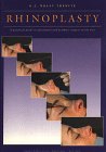 Rhinoplasty: A Practical Guide to Functional and Aesthetic Surgery of the Nose 9062990894 Book Cover