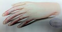Injuries and diseases of nerves and their surgical treatment B003KJVE8K Book Cover