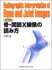 無料電子書籍 pdf 新装版骨・関節X線像の読み方 バイ