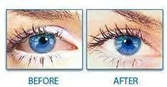 Original Laiter Collyre Bleu Eye Drops - 10ml