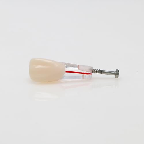 Generic 738252309397 10Pcs Dental Model Endodontic Root Canal Block Practice Teeth Pulp Cavity Resin Study Endo Training Tooth Rct Demo Student Teaching M8006-Mix Fit Kilgore Nissin 200 Type 28 Teeth thumb #5