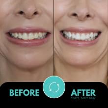 Image of intelliWHiTE ProStrips Teeth Whitening Strips, 7 Day Treatment, Whitens Up to 12 Shades, Enamel-Safe Gentle Remineralizing Formula, Dentist Formulated for Sensitive Teeth, (14pk Mint Flavor)