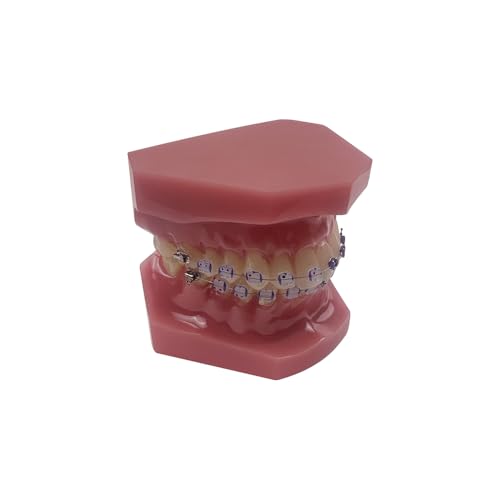 Orthodontisches Zahnmodell mit Halterungen, YOUYA DENTAL Demonstration Orthodontisches Modell für Bildung, Zähne Demonstration Typodonte Anatomisches Lehrwerkzeug mit Metall und Keramischer Halterung