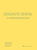  Desgaste Dental: El desafío por excelencia