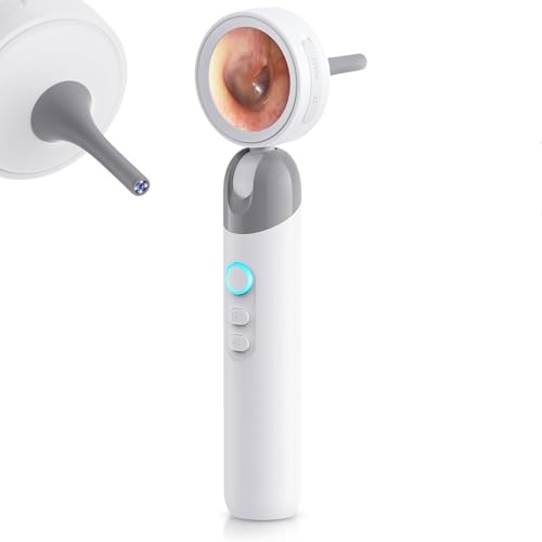 Otoscope Ear Camera with 1.38" IPS Screen, HD Ear Scope with LED Lights, Digital Otoscope for Adults, Kids &amp; Pets