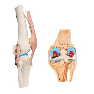 Kay Kay Industries Human Life Size Knee Joint Model and Human Mini Arthritic Knee Model Set | Hinghly Detailed and accurate Perfect for Medical Professionals and Training 1