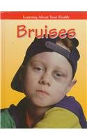 Library Binding Bruises Book