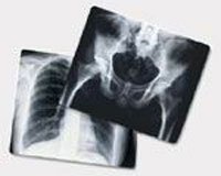 1135669 PT# EBA6A Film X-Ray AGFA 10x12