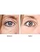 AMAZING FOR PUFFY EYES, DARK CIRCLE TREATMENT DERMISA ENHANCE APPEARANCE OJERAS