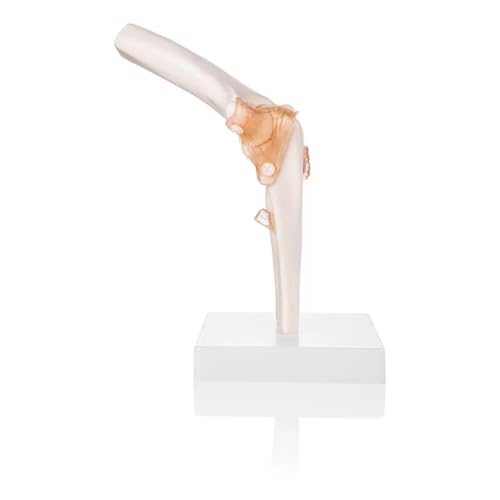 Image of Human Elbow Joint Model with Ligaments ✮ Scientific Life Size with Premium Display Base ✮ Best Teaching Tool for Patient Education & Anatomy Study
