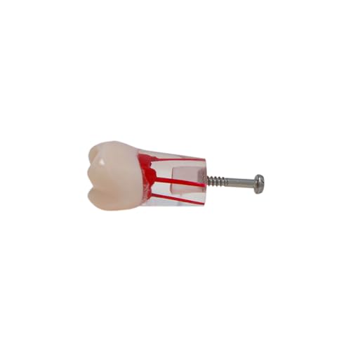 Generic 738252309397 10Pcs Dental Model Endodontic Root Canal Block Practice Teeth Pulp Cavity Resin Study Endo Training Tooth Rct Demo Student Teaching M8006-Mix Fit Kilgore Nissin 200 Type 28 Teeth thumb #7