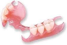 Custom-Made Flexible Partial Denture | Natural-Looking Teeth | Comfortable & Durable Pink Base | Dental Prosthetic for a Confident Smile (Lower02)