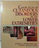 Color Atlas Of Cutaneous Disorders Of The Lower Extremities #TOP1