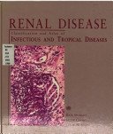 Renal Disease: Classification and Atlas of Infectious and Tropical Diseases 0891892583 Book Cover