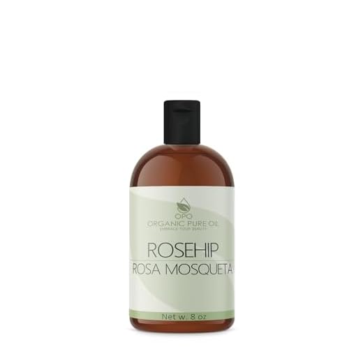 Rosehip Oil - 8 oz - 100% Pure, Unrefined, Non GMO, Cold Pressed, Vegan Carrier Oil for Face, Hair, Skin, Nails, Body Aging Skin Beard Locs Mustache Lashes - Premium Grade - Packaging May Vary - OPO