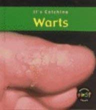 Hardcover Warts Book