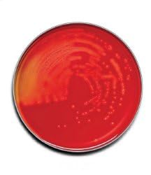 BD Medical Systems 221261 Trypticase Soy Agar with 5% Sheep Blood (TSA II) (Pack of 100)