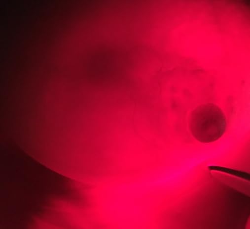 Équipement médical de diagnostic mammaire Luminous à LED rouge - 7