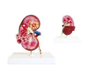 KAY KAY INDUSTRIES KIDNEY & CYST MODEL